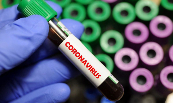 Президент підписав закон про додатковий соцзахист медиків та масове тестування на коронавірус